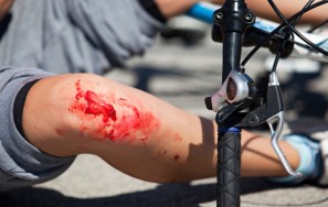 Cycling Accidents